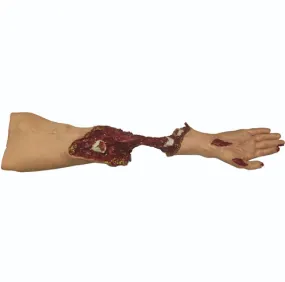 Simulaids Xtreme Trauma Moulage Arm